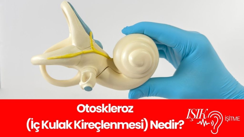OTOSKLEROZ İÇ KULAK KİREÇLENMESİ NEDİR OTOSKLEROZ İÇ KULAK KİREÇLENMESİ NEDİR